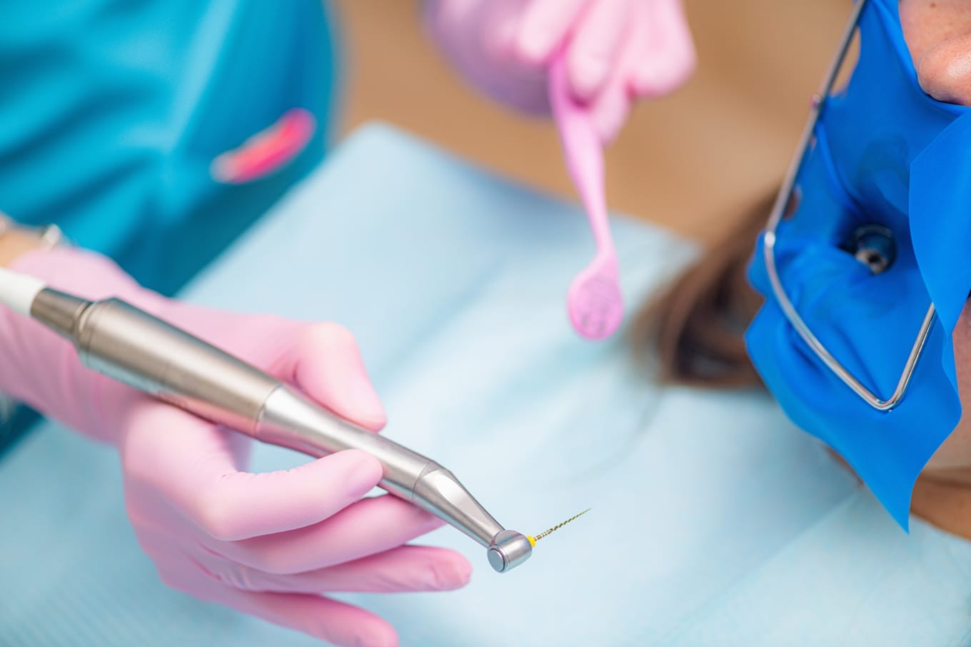 Endodoncja w Krakowie – leczenie kanałowe zębów