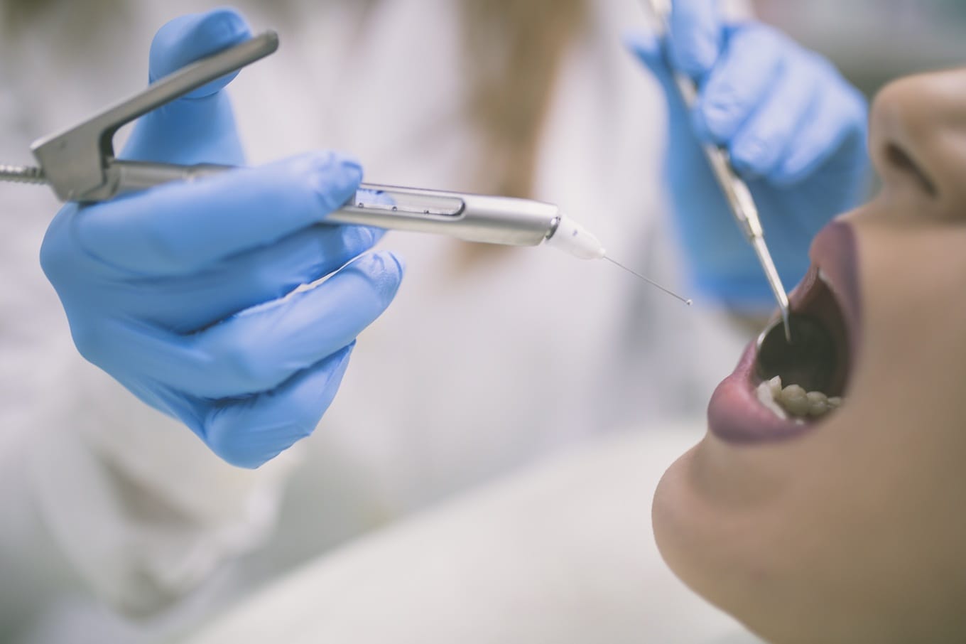 Znieczulenie w leczeniu kanałowym – klucz do komfortu